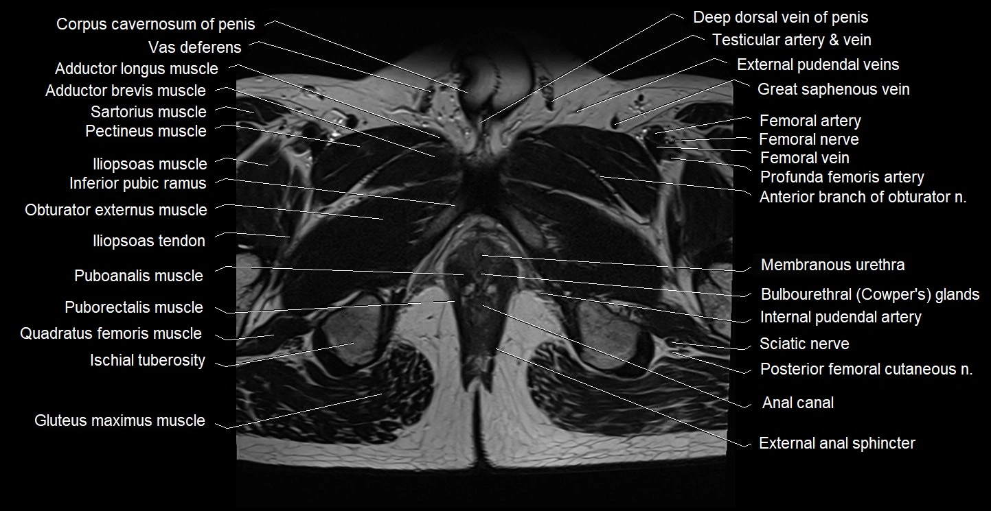 Male pelvis axial cross sectional anatomy image 40.webp